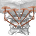 San Diego Chiropractor El Cajon La Mesa Santee Headaches Whiplash