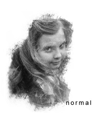 normal