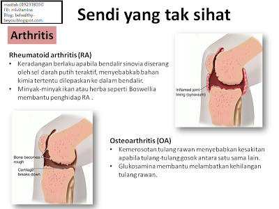 sakit-sendi