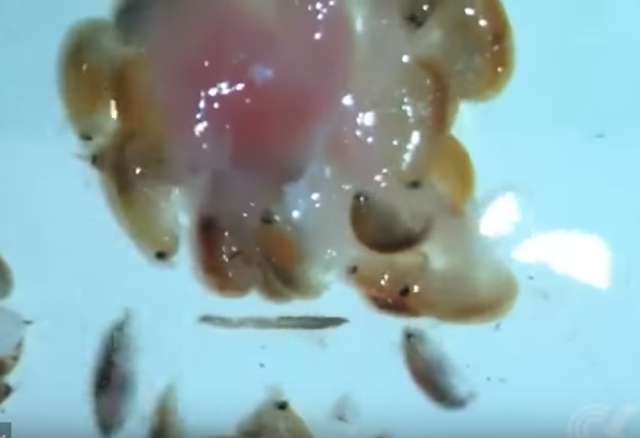This teen dips his feet into the water but ends up getting a bloodied feet after the flesh-eating bugs fed on his feet! 