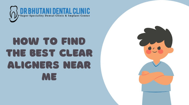 Best Clear Aligners Near Me