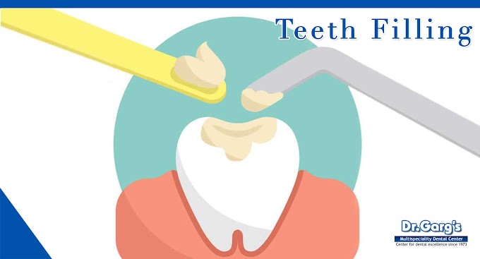 Discovering Teeth Filling Charges in India