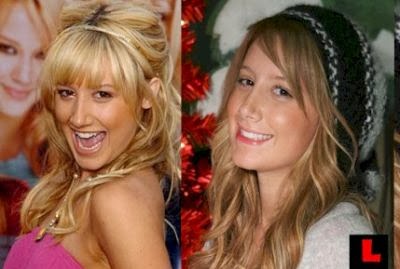 Ashley Tisdale nose job before and after photo