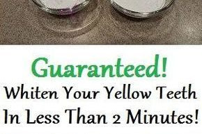 Guaranteed Teeth Whitening In Less Than 2 Minutes!