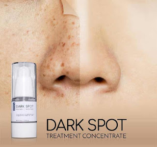 ERTO'S Dark Spot Treatment Concentrate ERTOS Serum 15ml Original BPOM