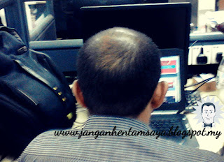 Info tentang Keguguran Rambut