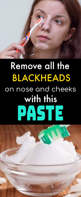 How To Remove Blackheads And Whiteheads Forever Using Salt And Toothpaste