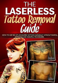 Laserless Tattoo Removal Guide Review — Does Natural Tattoo Removal Exist?