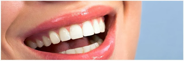 http://www.ndentalworks.com/dental-exam-cleaning.html