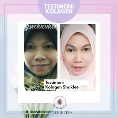 Kolagen, collagen powder shaklee, testimoni, antipenuaan, awet muda, kulit kendur, payudara kendur, jerawat, jeragat, pigmentasi, sumber kolagen, kesan penggunaan kolagen, manfaat kolagen, 