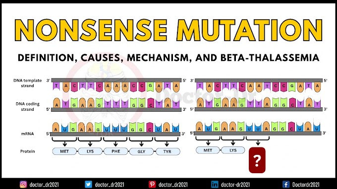 Nonsense Mutation: Definition, Causes, Mechanism, Applications & Example of Beta-Thalassemia