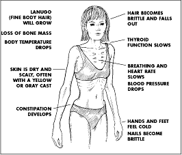  eating disorder counseling clinic in chennai