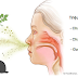 Nguồn gốc chính dẫn đến b���nh viêm mũi xoang kinh niên