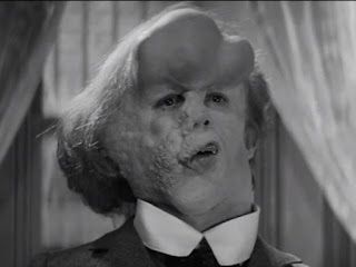 Joseph Merrick