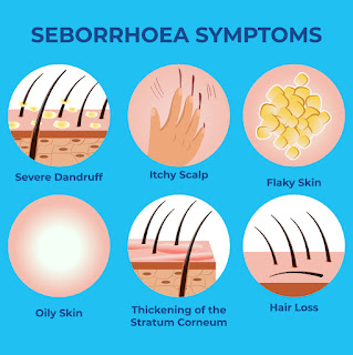 Seborrheic dermatitis symptoms