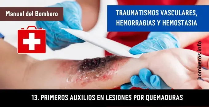 Primeros auxilios en lesiones por quemaduras