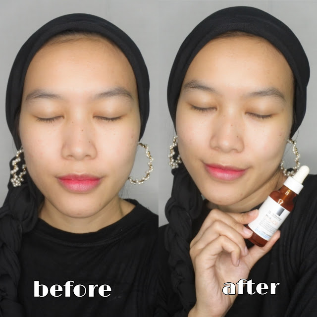 Review La Roche Posay Pure Vitamin C10 Serum