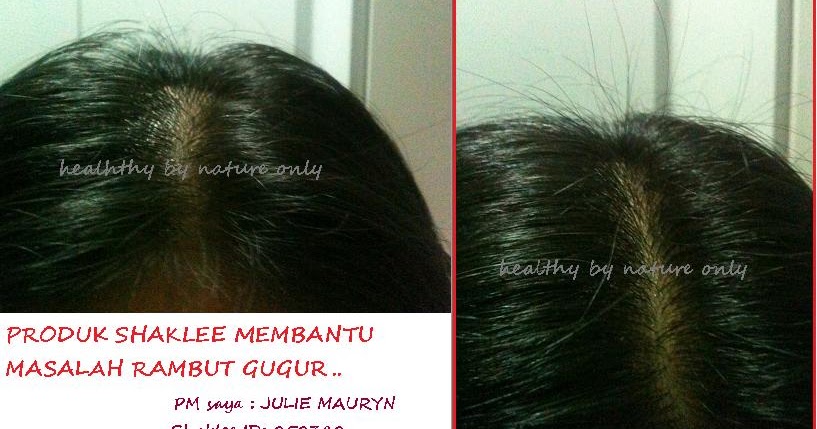 HEALTHY by NATURE MASALAH  RAMBUT  GUGUR  YANG TIDAK NORMAL