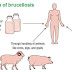 Brucellosis ( Brucella infection in humans: Mediterranean fever, Malta fever )