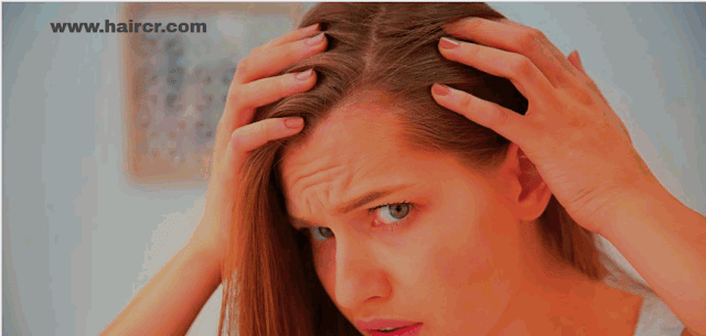 A quick solution to heavy hair loss