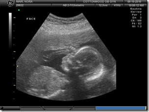 BABY_49