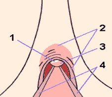 http://bloggerkeppo.blogspot.com/2014/02/g-spot-vs-klitoris.html