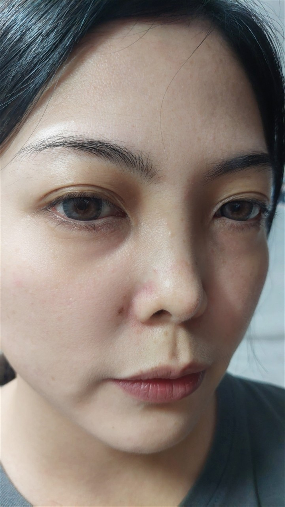 護膚｜LADES藍帝絲時光淨透水， 無需蒸氣 5分鐘浮出粉刺