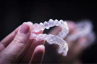 nieng-rang-invisalign