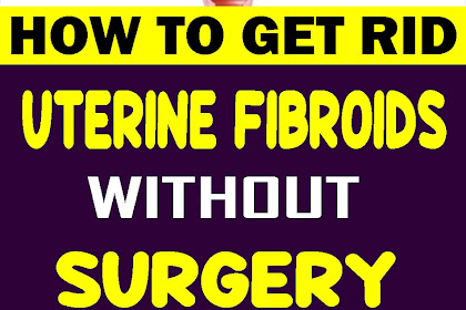 How to Get Rid of Uterine Fibroids without Surgery