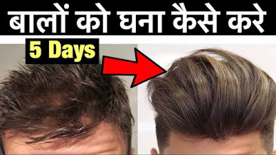 Balo Ko Ghana Kaise Kare