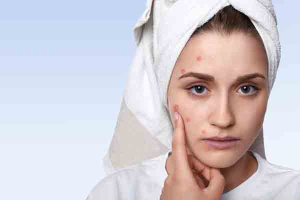 10 Benefits of Applying Neem Paste on Face