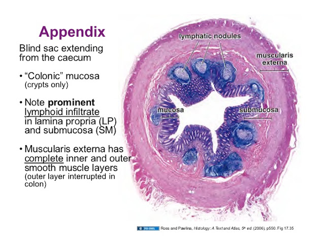  Appendicitis-Naturally treat appendicitis with Home Remedies