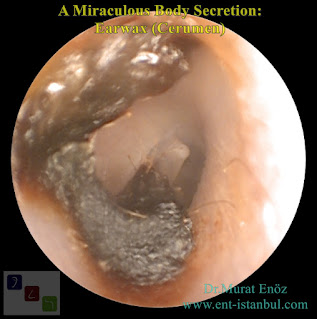 A Miraculous Body Secretion: Earwax (Cerumen)