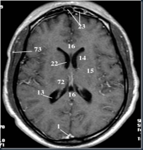 AnOtak Axial1