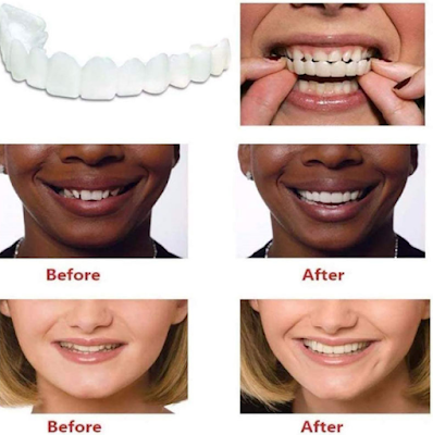 Профессиональная защита зубов: чехол для ложных зубов