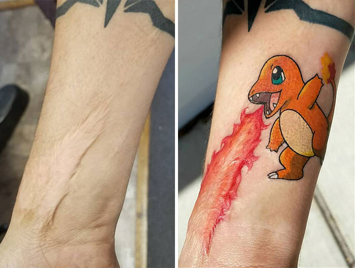 30 Times Tattoo Artists Did An Awesome Job Covering Up People's Scars And Birthmarks