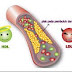 cara cepat dan tepat mengatasi kolesterol tinggi setelah mengetahui gejala awal kolesterol tinggi
