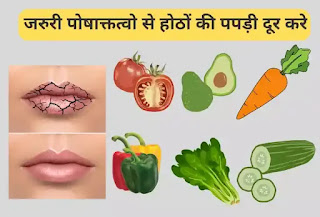 Hothon Par Papadi Aana karan Lakshan Gharelu Upay Hindi, होठों पर पपड़ी आना कारन लक्षण, होठों पर पपड़ी आना घरेलू उपचार