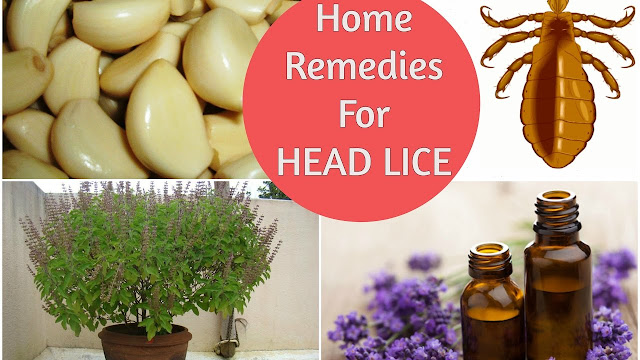 Natural Remedy for Head Lice