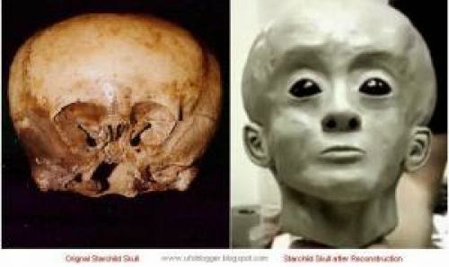 Extraterrestrial Dna Found In 900 Year Old Starchild Skull