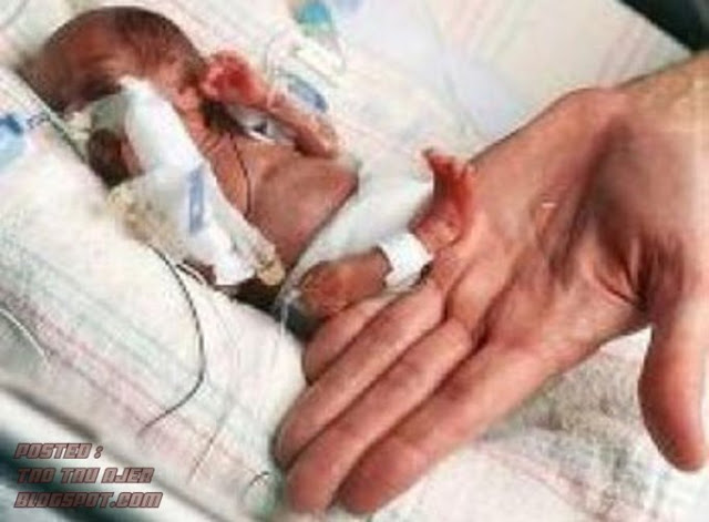 WOW! - CAROLINA TERZIS bayi terkecil lahir di Brazil (3 