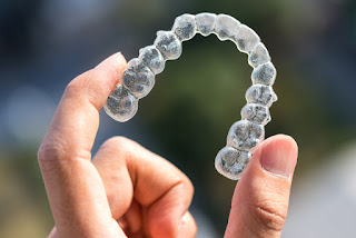 Dental Braces Types Advantages And Disadvantages