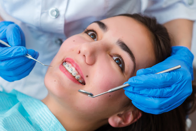 Dental Braces Market