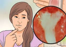 Kencing Sakit Dan Keluar Nanah Serta Perih Kencing Sakit Dan Keluar Nanah Serta Perih
