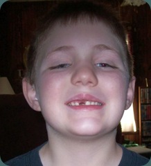 nicks tooth