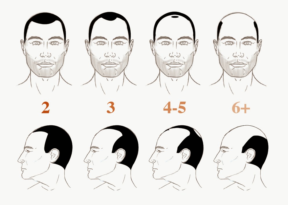 HOW BALD ARE YOU? ~ THE MALE GROOMING REVIEW