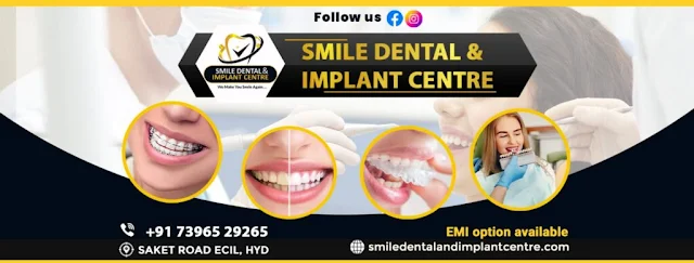 best dental clinic in cherlapally