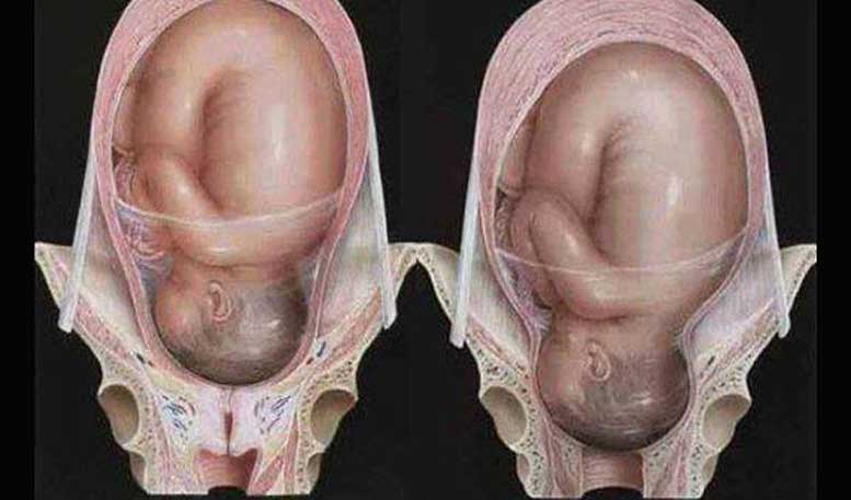 Rahim Ibu Mengembang 500 Kali Lipat dan Mampu Menahan Rasa Sakit Seperti 20 Tulang Yang Patah Bersamaan.