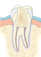 Bild på rotfyllning av tand - genomskärning
