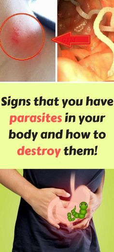 Signs that you have parasites in your body and how to destroy them!